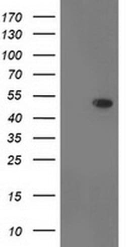 Invitrogen DOK2 Monoclonal Antibody (OTI2D10) 100 &mu;L; Unconjugated:Antibodies,