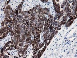 Invitrogen HSPBP1 Monoclonal Antibody (OTI1F3) 100 &mu;L; Unconjugated:Antibodies,