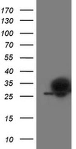 Invitrogen PGAM2 Monoclonal Antibody (OTI4E9) 100 &mu;L; Unconjugated:Antibodies,