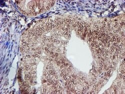 Invitrogen CYP17A1 Monoclonal Antibody (OTI3F11) 100 &mu;L; Unconjugated:Antibodies,