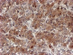 Invitrogen CYP17A1 Monoclonal Antibody (OTI3F11) 100 &mu;L; Unconjugated:Antibodies,
