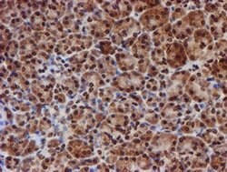 Invitrogen CYP17A1 Monoclonal Antibody (OTI3F11) 100 &mu;L; Unconjugated:Antibodies,