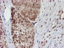 Invitrogen CYP17A1 Monoclonal Antibody (OTI3F11) 100 &mu;L; Unconjugated:Antibodies,