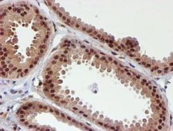 Invitrogen CYP17A1 Monoclonal Antibody (OTI3F11) 100 &mu;L; Unconjugated:Antibodies,
