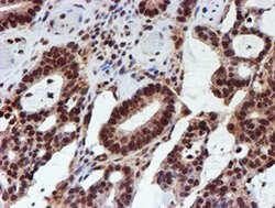 Invitrogen CYP17A1 Monoclonal Antibody (OTI3F11) 100 &mu;L; Unconjugated:Antibodies,