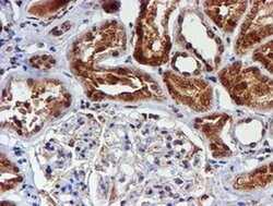 Invitrogen CYP17A1 Monoclonal Antibody (OTI3F11) 100 &mu;L; Unconjugated:Antibodies,