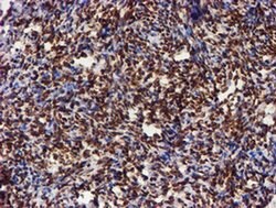Invitrogen CYP17A1 Monoclonal Antibody (OTI3F11) 100 &mu;L; Unconjugated:Antibodies,