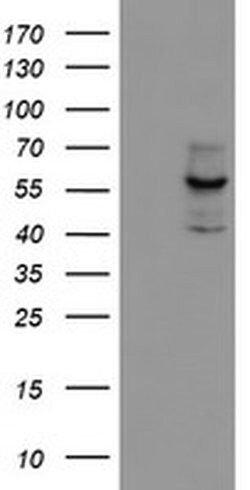 Invitrogen CYP17A1 Monoclonal Antibody (OTI3F11) 100 &mu;L; Unconjugated:Antibodies,