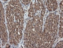 Invitrogen PNPO Monoclonal Antibody (OTI1G9) 100 &mu;L; Unconjugated:Antibodies,