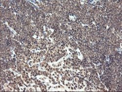 Invitrogen PNPO Monoclonal Antibody (OTI1G9) 100 &mu;L; Unconjugated:Antibodies,