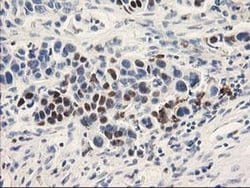 Invitrogen UNG Monoclonal Antibody (OTI1A11) 100 &mu;L; Unconjugated:Antibodies,