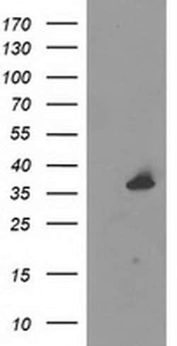 Invitrogen UNG Monoclonal Antibody (OTI1A11) 100 &mu;L; Unconjugated:Antibodies,