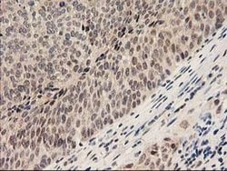 Invitrogen PSMB4 Monoclonal Antibody (OTI2C9) 100 &mu;L; Unconjugated:Antibodies,