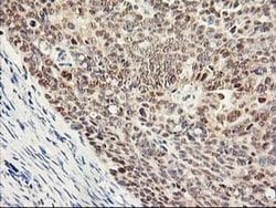 Invitrogen PSMB4 Monoclonal Antibody (OTI2C9) 100 &mu;L; Unconjugated:Antibodies,
