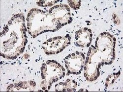 Invitrogen PSMB4 Monoclonal Antibody (OTI2C9) 100 &mu;L; Unconjugated:Antibodies,