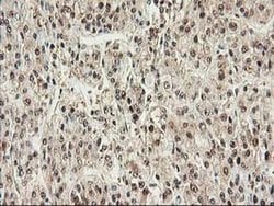 Invitrogen PSMB4 Monoclonal Antibody (OTI2C9) 100 &mu;L; Unconjugated:Antibodies,