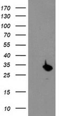 Invitrogen PSMB4 Monoclonal Antibody (OTI2C9) 100 &mu;L; Unconjugated:Antibodies,