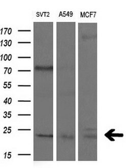 Invitrogen CDKN3 Monoclonal Antibody (OTI2H1) 100 &mu;L | Buy Online | Invitrogen&trade; | Fisher Scientific