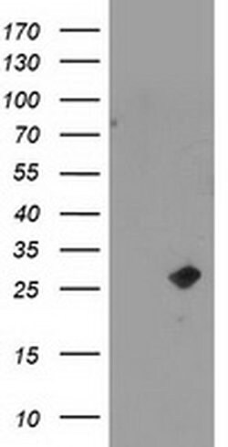 Invitrogen CDKN3 Monoclonal Antibody (OTI2H1) 100 &mu;L | Buy Online | Invitrogen&trade; | Fisher Scientific