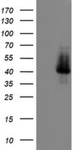 Invitrogen ELK3 Monoclonal Antibody (OTI1H3) 100 &mu;L; Unconjugated:Antibodies,