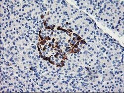 Invitrogen ACSS2 Monoclonal Antibody (OTI3H4) 100 &mu;L; Unconjugated:Antibodies,