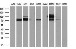 Invitrogen ACSS2 Monoclonal Antibody (OTI3H4) 100 &mu;L; Unconjugated:Antibodies,