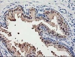Invitrogen ACSS2 Monoclonal Antibody (OTI2C6) 100 &mu;L; Unconjugated:Antibodies,