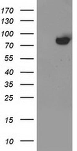 Invitrogen ACSS2 Monoclonal Antibody (OTI2C6) 100 &mu;L; Unconjugated:Antibodies,