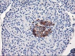 Invitrogen ACSS2 Monoclonal Antibody (OTI3B12) 100 &mu;L; Unconjugated:Antibodies,
