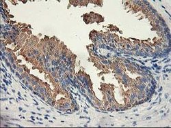 Invitrogen ACSS2 Monoclonal Antibody (OTI3B12) 100 &mu;L; Unconjugated:Antibodies,