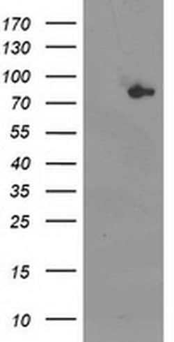 Invitrogen ACSS2 Monoclonal Antibody (OTI3B12) 100 &mu;L; Unconjugated:Antibodies,