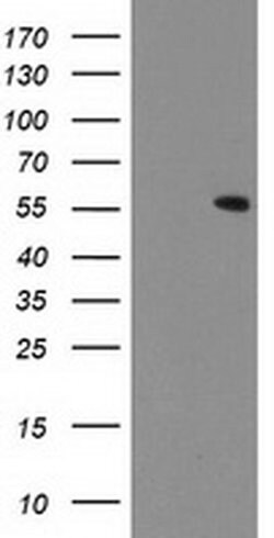 Invitrogen CNDP2 Monoclonal Antibody (OTI6D3) 100 &mu;L; Unconjugated:Antibodies,