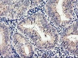 Invitrogen CYP2J2 Monoclonal Antibody (OTI5C5) 100 &mu;L; Unconjugated:Antibodies,