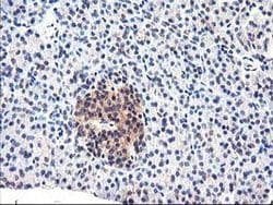 Invitrogen CYP2J2 Monoclonal Antibody (OTI5C5) 100 &mu;L; Unconjugated:Antibodies,