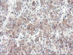 Invitrogen CYP2J2 Monoclonal Antibody (OTI5C5) 100 &mu;L; Unconjugated:Antibodies,