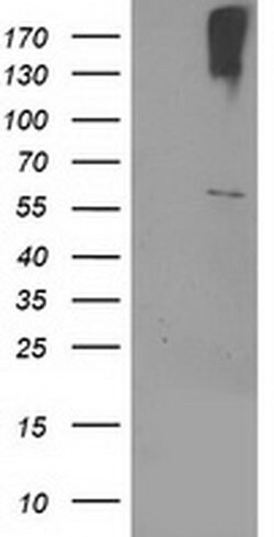 Invitrogen CYP2J2 Monoclonal Antibody (OTI5C5) 100 &mu;L; Unconjugated:Antibodies,