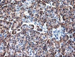 Ribophorin I Monoclonal Antibody (OTI6A9):Antibodies, Monoclonal