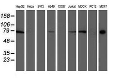 Ribophorin I Monoclonal Antibody (OTI6A9):Antibodies, Monoclonal