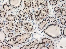 Invitrogen PIG3 Monoclonal Antibody (OTI3B11) 100 &mu;L; Unconjugated:Antibodies,
