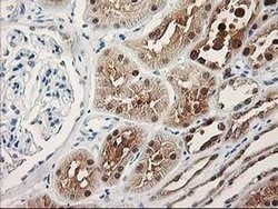 Invitrogen PIG3 Monoclonal Antibody (OTI3B11) 100 &mu;L; Unconjugated:Antibodies,