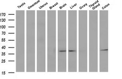 Invitrogen PIG3 Monoclonal Antibody (OTI3B11) 100 &mu;L; Unconjugated:Antibodies,