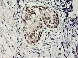 Invitrogen SERPINB13 Monoclonal Antibody (OTI2B6) 100 &mu;L; Unconjugated:Antibodies,
