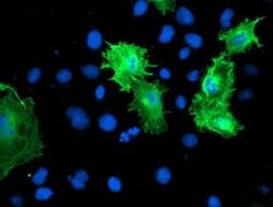 Invitrogen Calponin 2 Monoclonal Antibody (OTI2B5) 100 &mu;L; Unconjugated:Antibodies,
