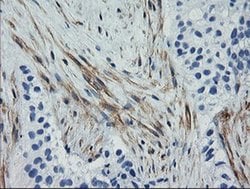 Invitrogen Calponin 2 Monoclonal Antibody (OTI2B5) 100 &mu;L; Unconjugated:Antibodies,