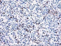 Invitrogen Calponin 2 Monoclonal Antibody (OTI2B5) 100 &mu;L; Unconjugated:Antibodies,