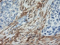 Invitrogen Calponin 2 Monoclonal Antibody (OTI2B5) 100 &mu;L; Unconjugated:Antibodies,