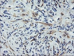 Invitrogen Calponin 2 Monoclonal Antibody (OTI2B5) 100 &mu;L; Unconjugated:Antibodies,