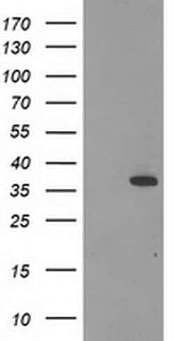 Invitrogen Calponin 2 Monoclonal Antibody (OTI2B5) 100 &mu;L; Unconjugated:Antibodies,