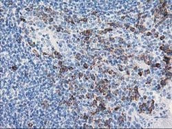 Invitrogen AIPL1 Monoclonal Antibody (OTI3B4) 100 &mu;L; Unconjugated:Antibodies,