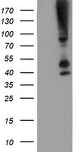 Invitrogen SERPINB13 Monoclonal Antibody (OTI1A7) 100 &mu;L; Unconjugated:Antibodies,